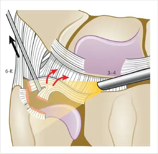 10 1055 b 006 163753 c084 f004.jpg