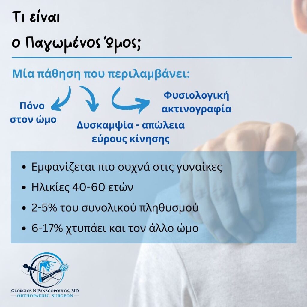 Παγωμένος ώμος - Επιδημιολογία & αίτια