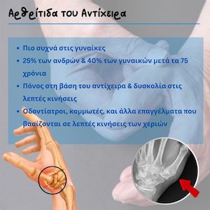 Thumb arthritis2